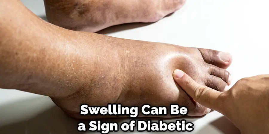 Swelling Can Be a Sign of Diabetic